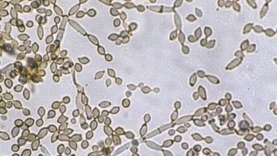 클라도스포리움
